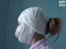 16-летняя участница фаер-шоу из Твери сожгла себе лицо, выдувая огонь. ВИДЕО