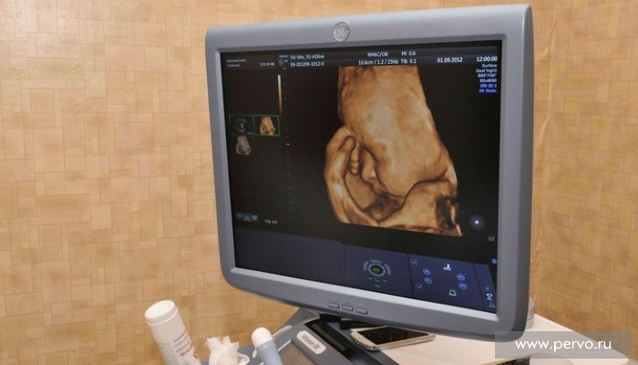 В Первоуральске работает аппарат УЗИ экспертного класса