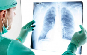 Лучшие клиники для лечения рака легких для пациентов из СНГ