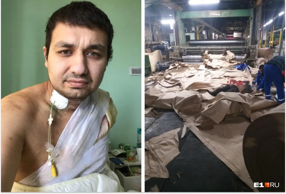 Первоуралец, которого затянуло в станок по самое сердце, судится с ГУФСИН