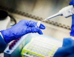 Армения перестанет передавать Пентагону образцы опасных патогенов