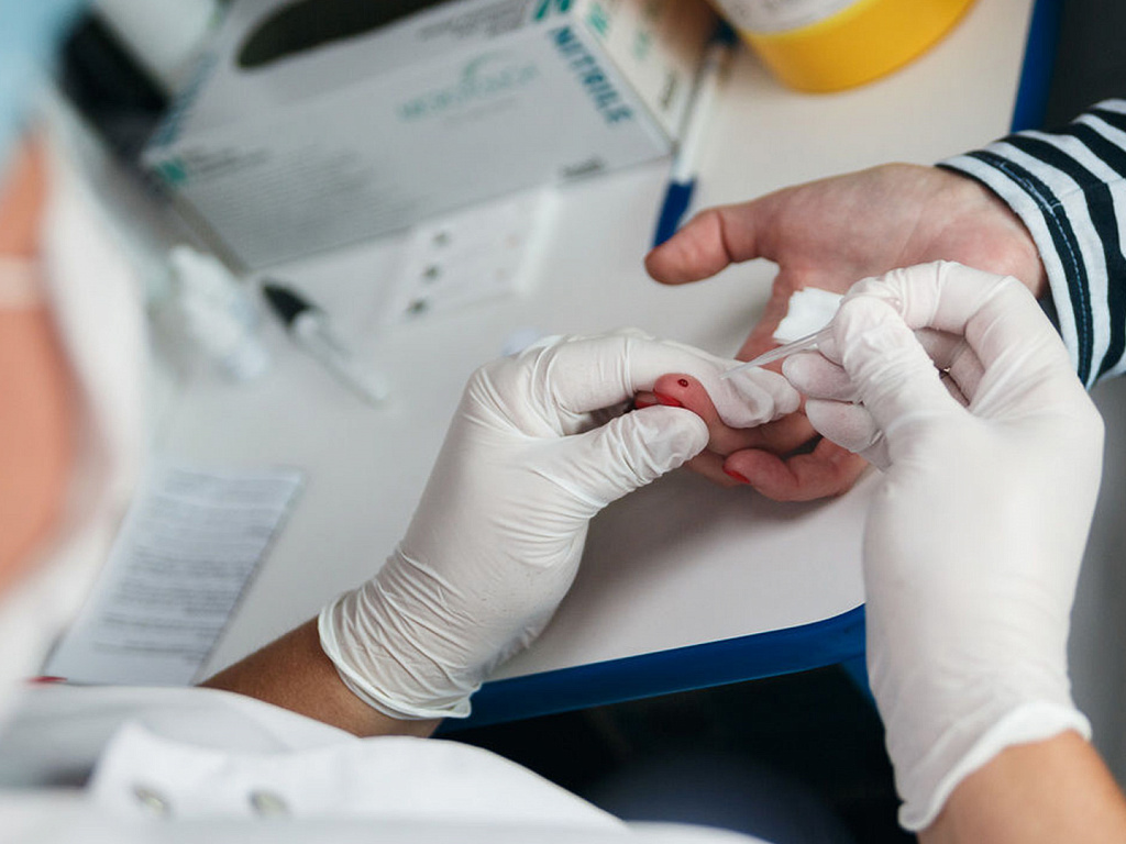 Первоуральцы могут бесплатно заказать наборы для самотестирования на ВИЧ