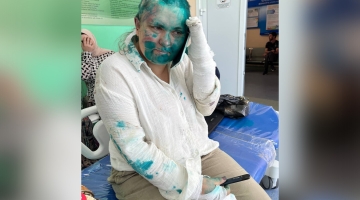 Чеченский омбудсмен дал свою оценку нападению на журналистку Милашину и адвоката