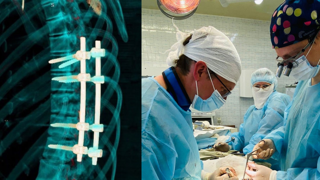 Пассажирке упавшего вертолета проведут третью операцию