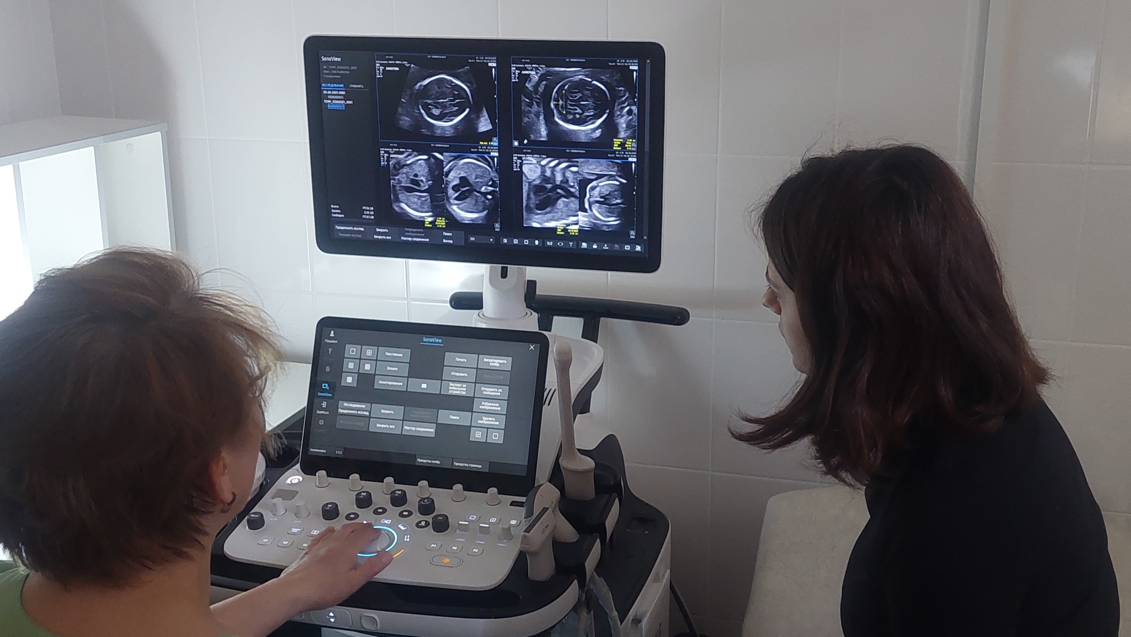 В городской больнице установили аппарат УЗИ экспертного класса