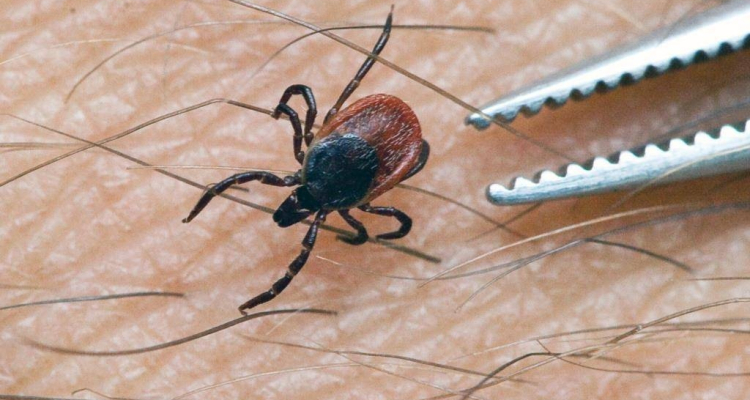 С начала сезона клещи покусали 35 жителей Первоуральска