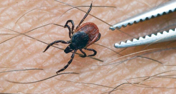 За майские праздники от клещей пострадало 20 детей