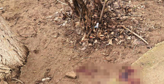 В Волгограде врачи борются за жизнь девочки, выпавшей из окна четвертого этажа