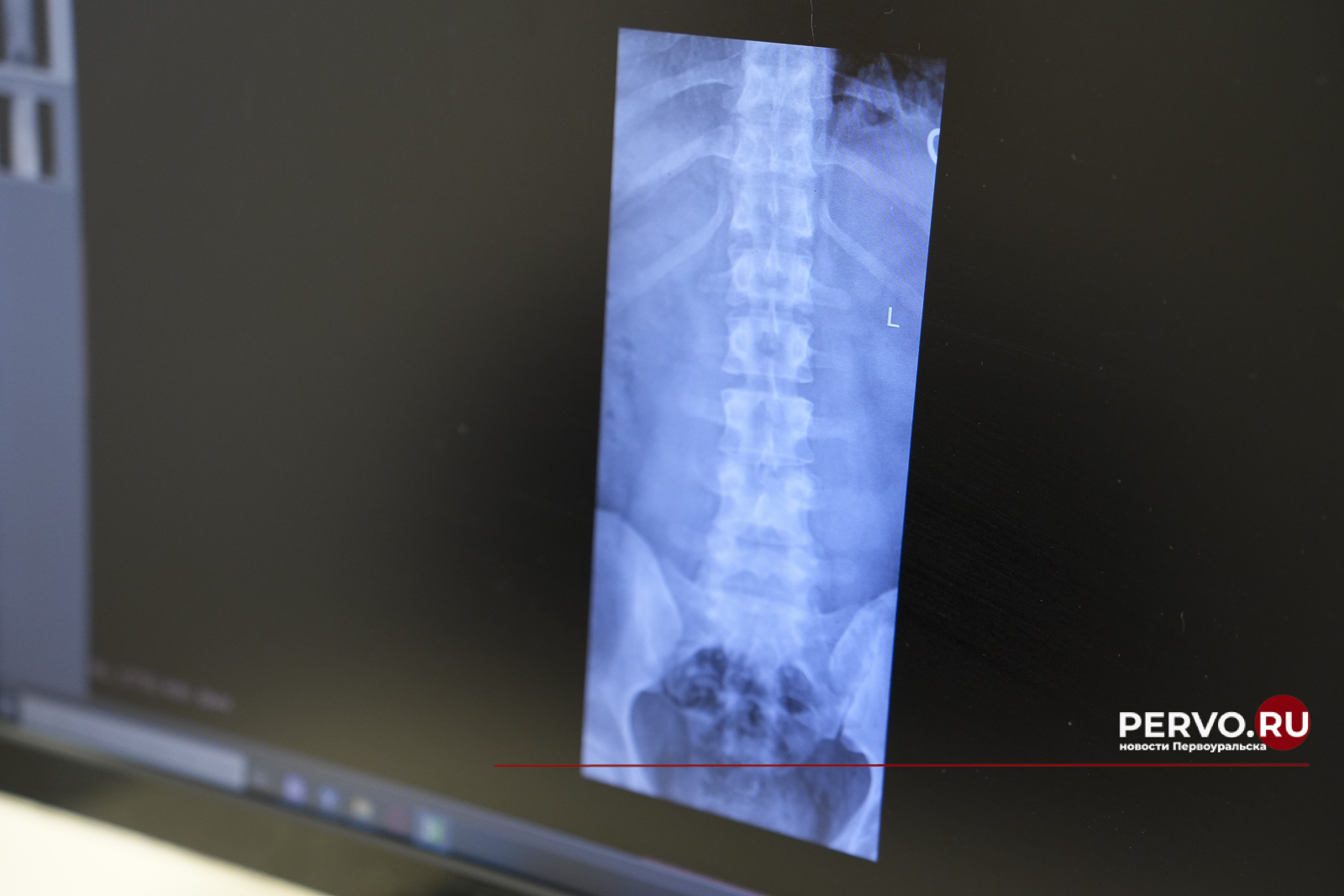 В Первоуральске после ремонта открыли травмопункт